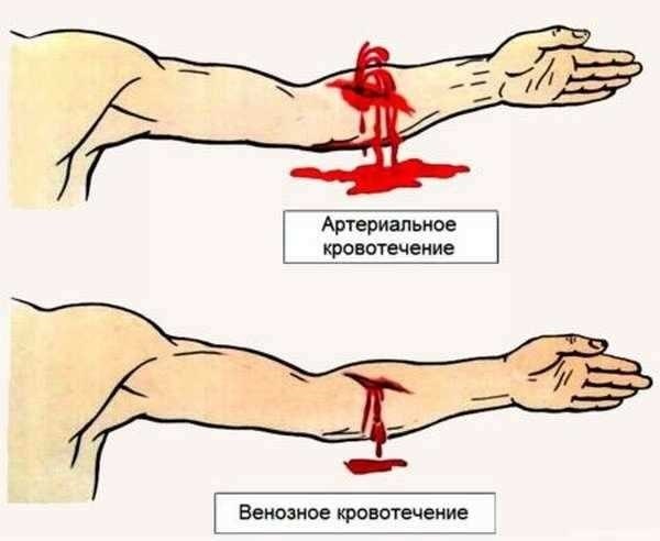 Обозначение группы крови